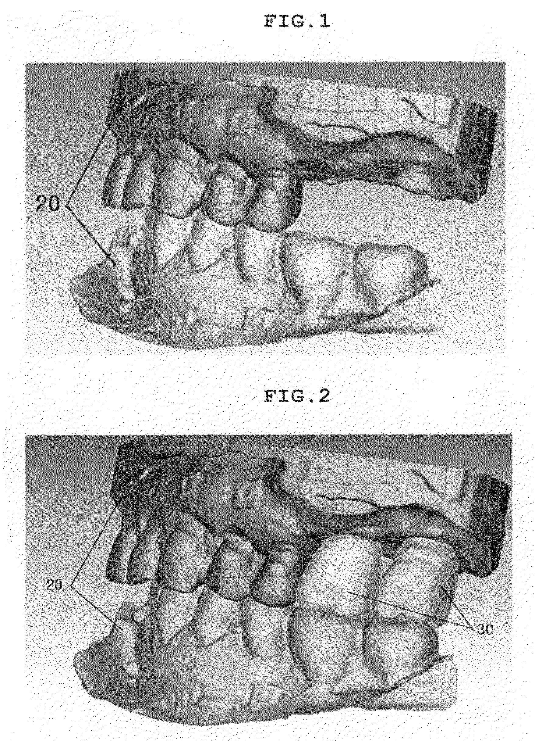 Method for manufacturing the one body abutment of implant