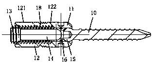 Scoliosis screw-rod correction stent system