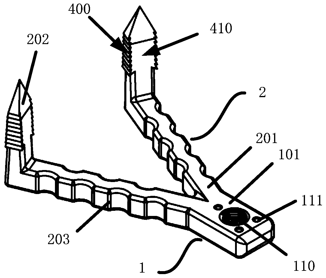 Locking Compression Screw-Plate System