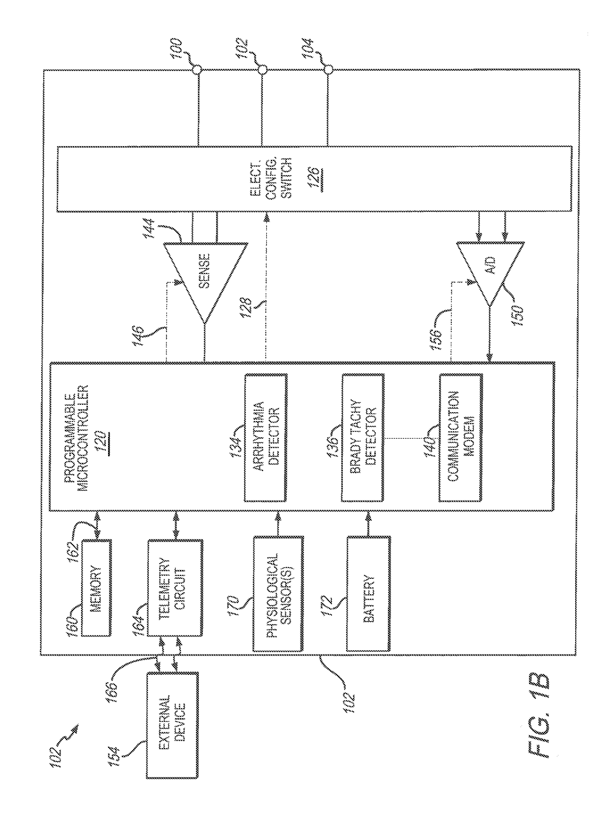 Method and system to discriminate rhythm patterns in cardiac activity