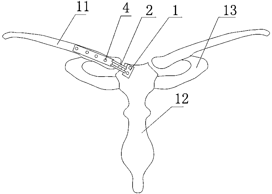 Movable bone connecting plate