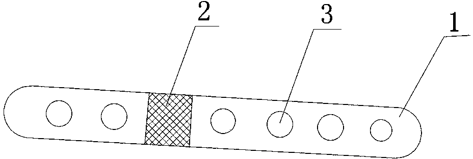 Movable bone connecting plate