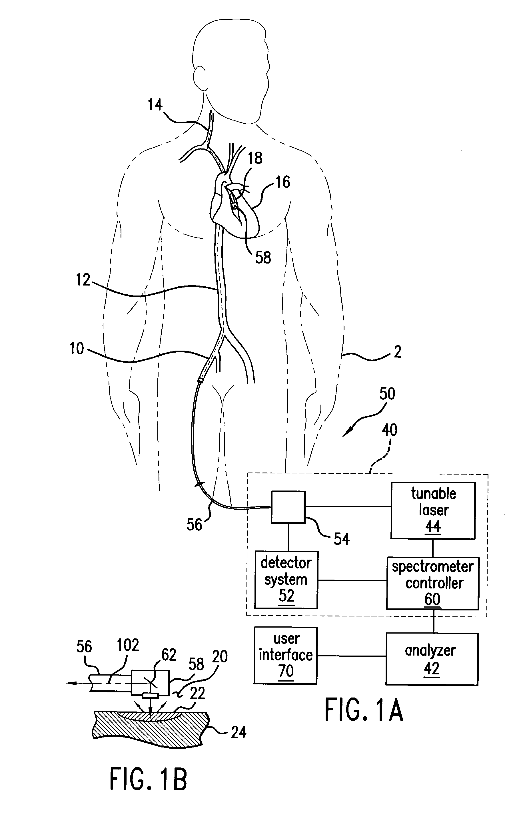 Spectroscopic unwanted signal filters for discrimination of vulnerable plaque and method therefor