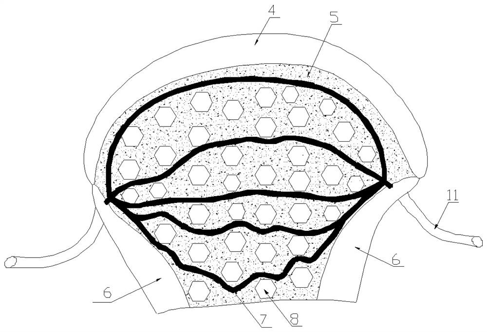 Cartilage-bone-bone marrow composite tissue structure and method based on living cell 3D printing