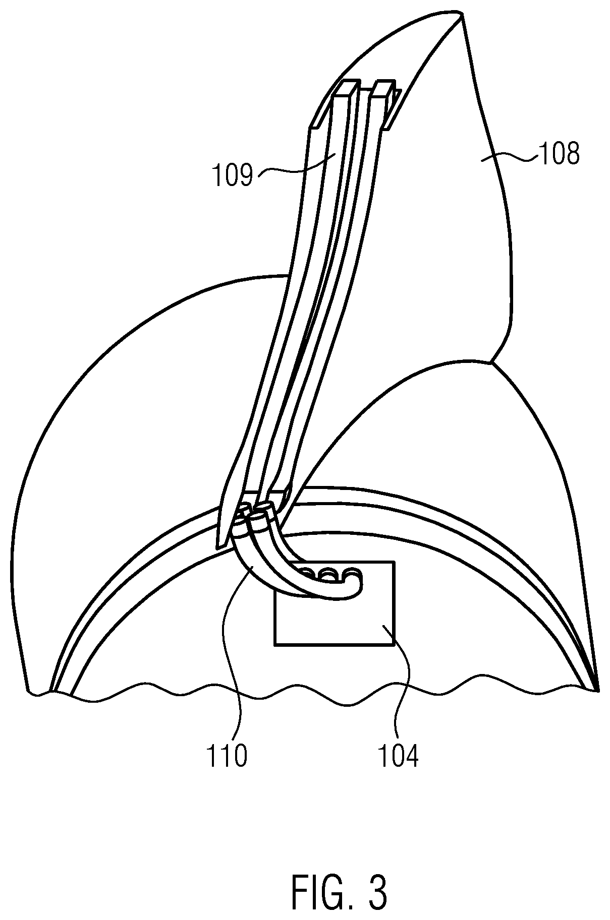 Aircraft engine