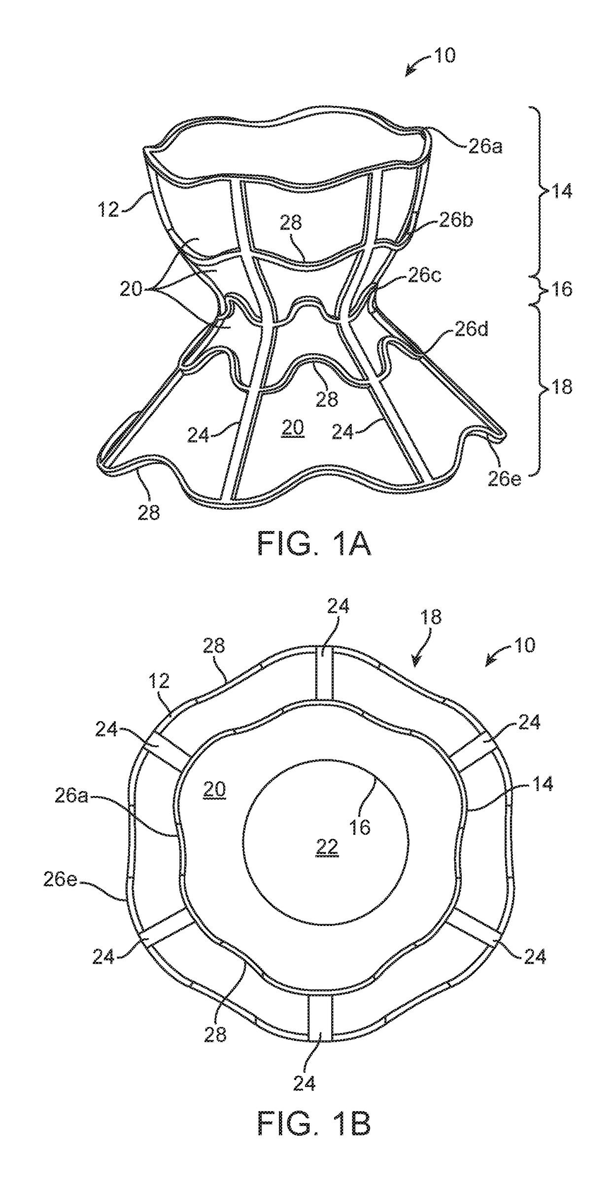 Shunt for redistributing atrial blood volume