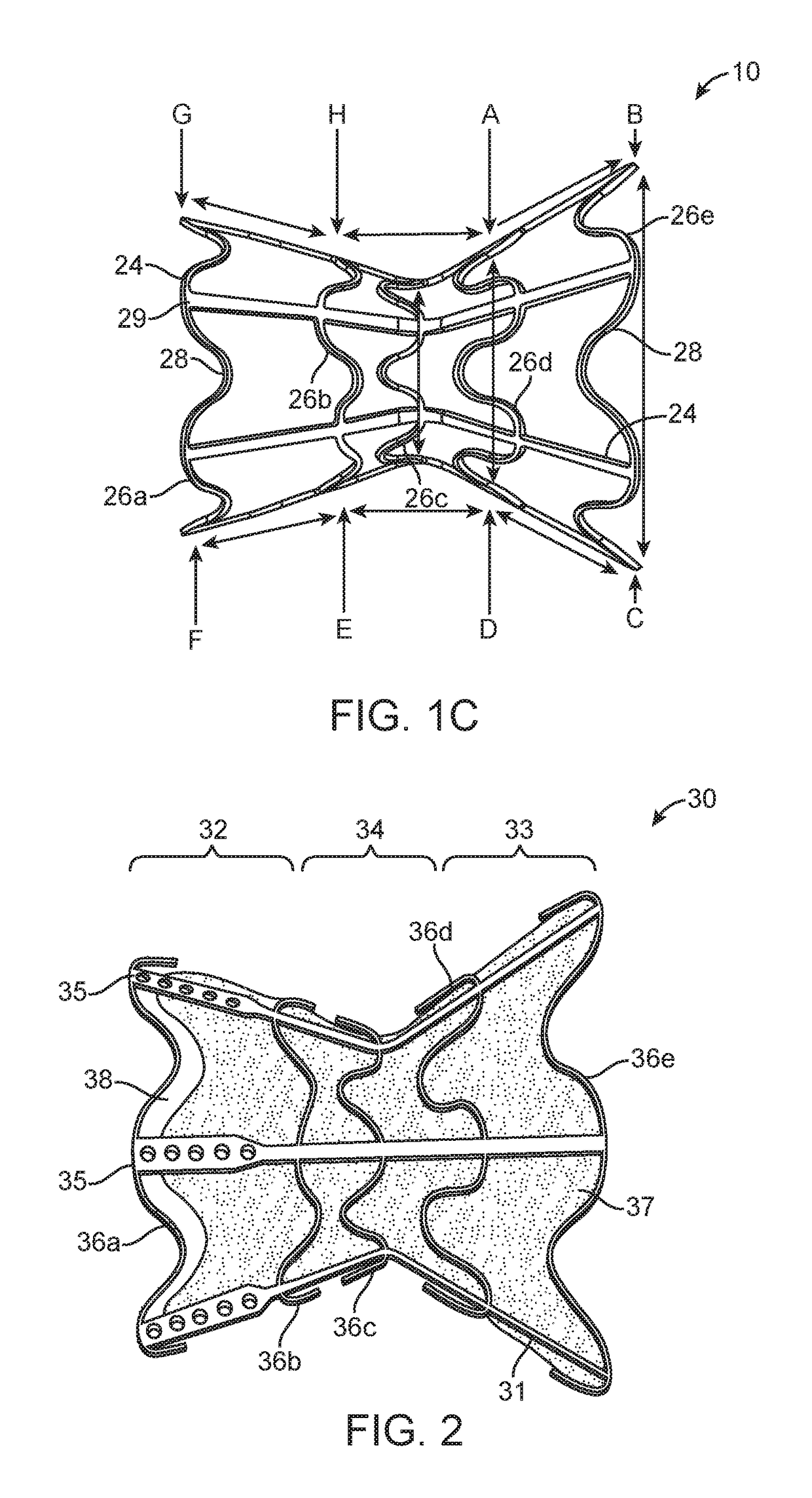 Shunt for redistributing atrial blood volume