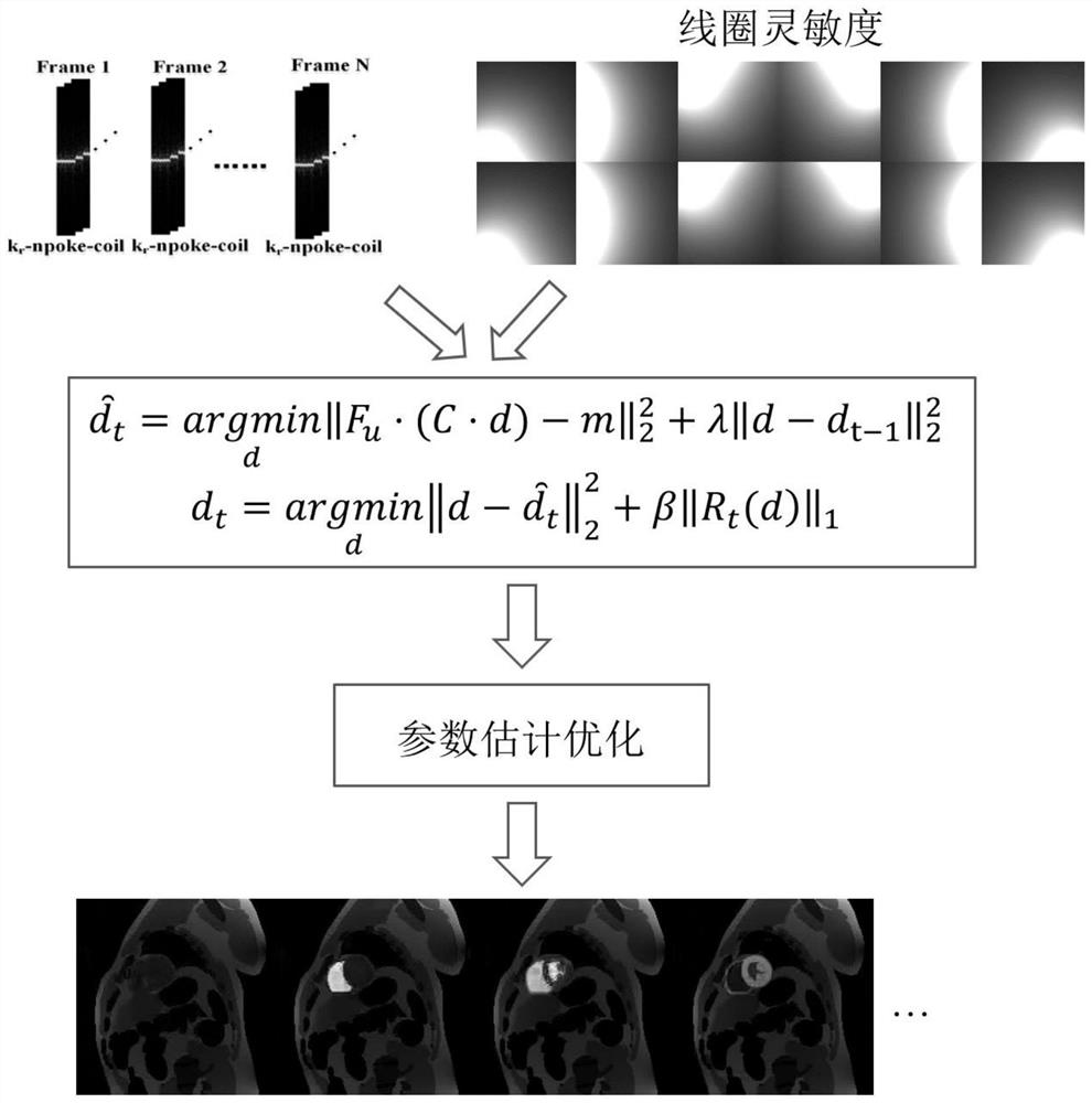 VBM3d-based magnetic resonance image reconstruction method