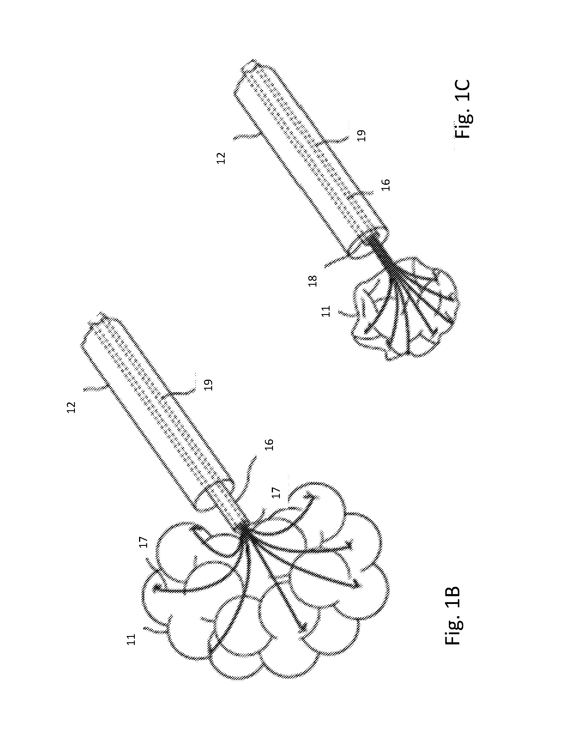 System and method for treating COPD and emphysema