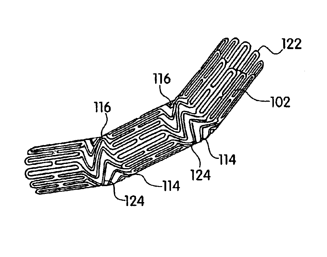 Articulated stent