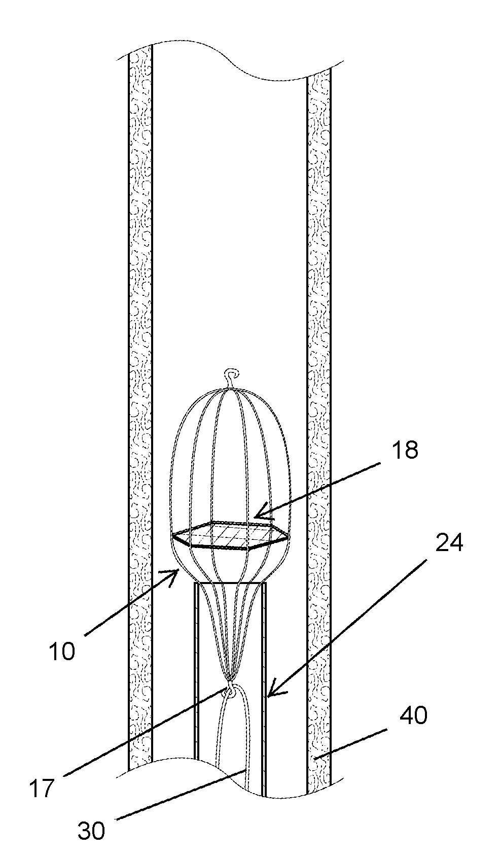 Bidirectional Vascular Filter and Method of Use