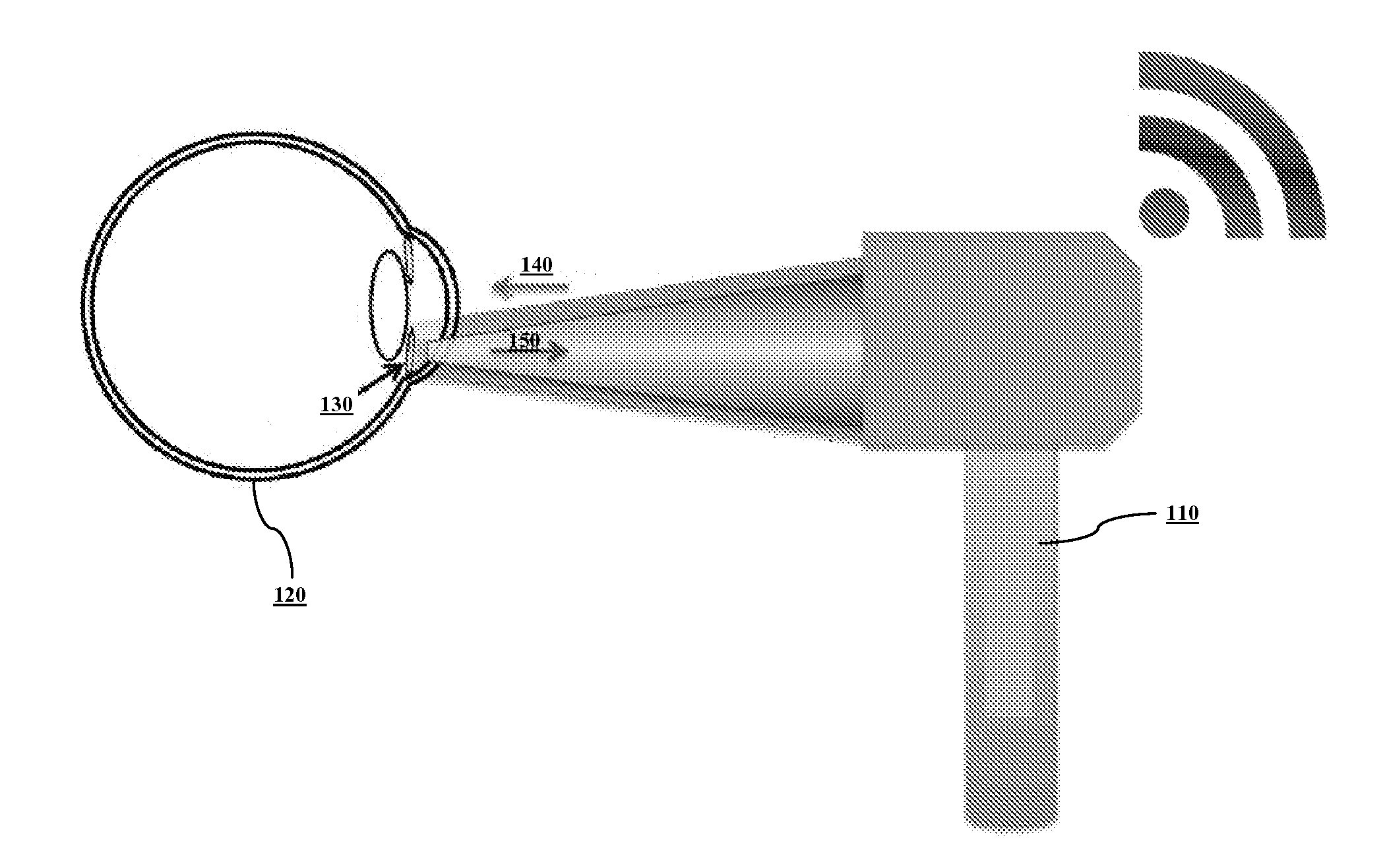 System and method for sensing intraocular pressure