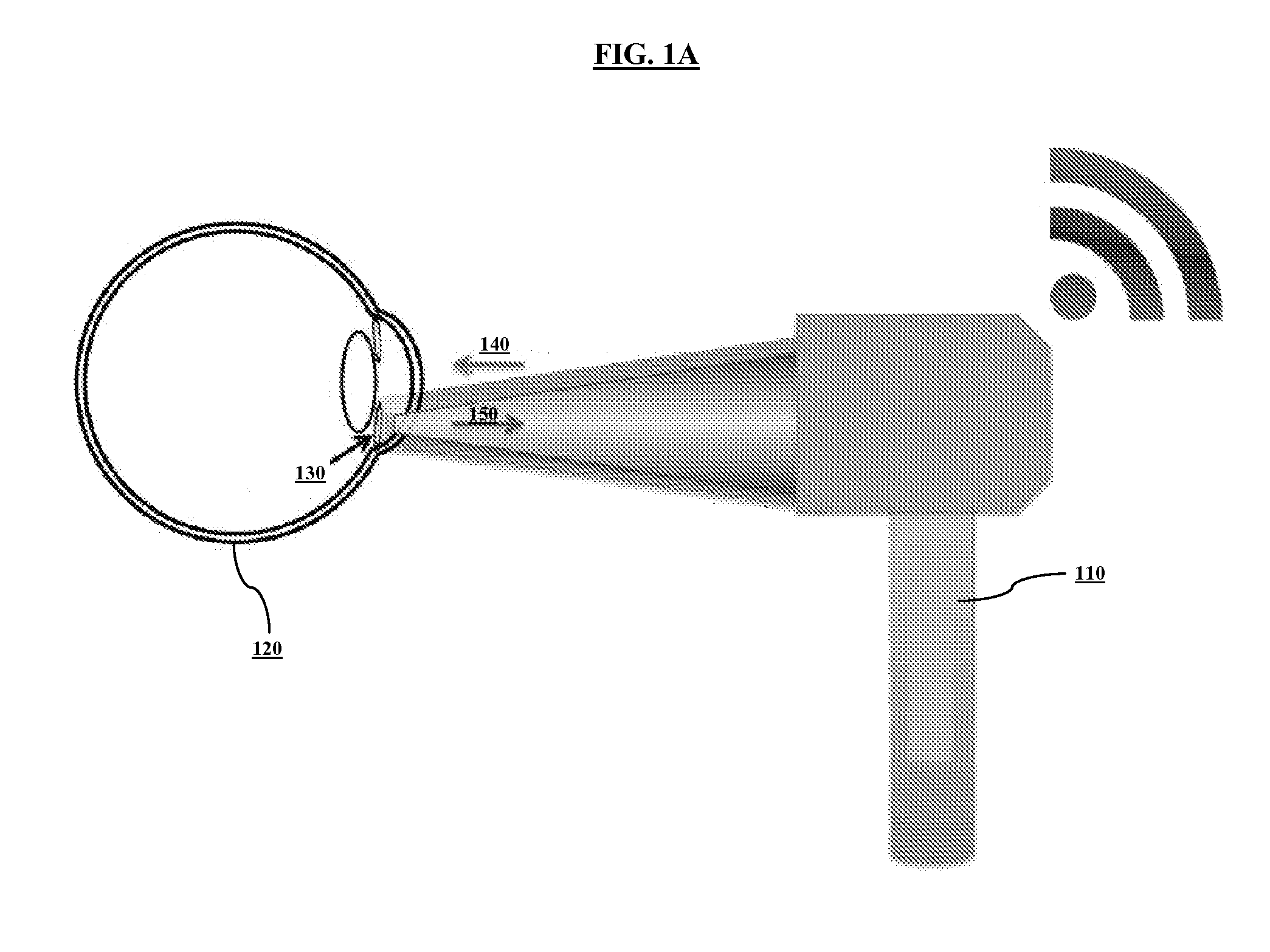 System and method for sensing intraocular pressure