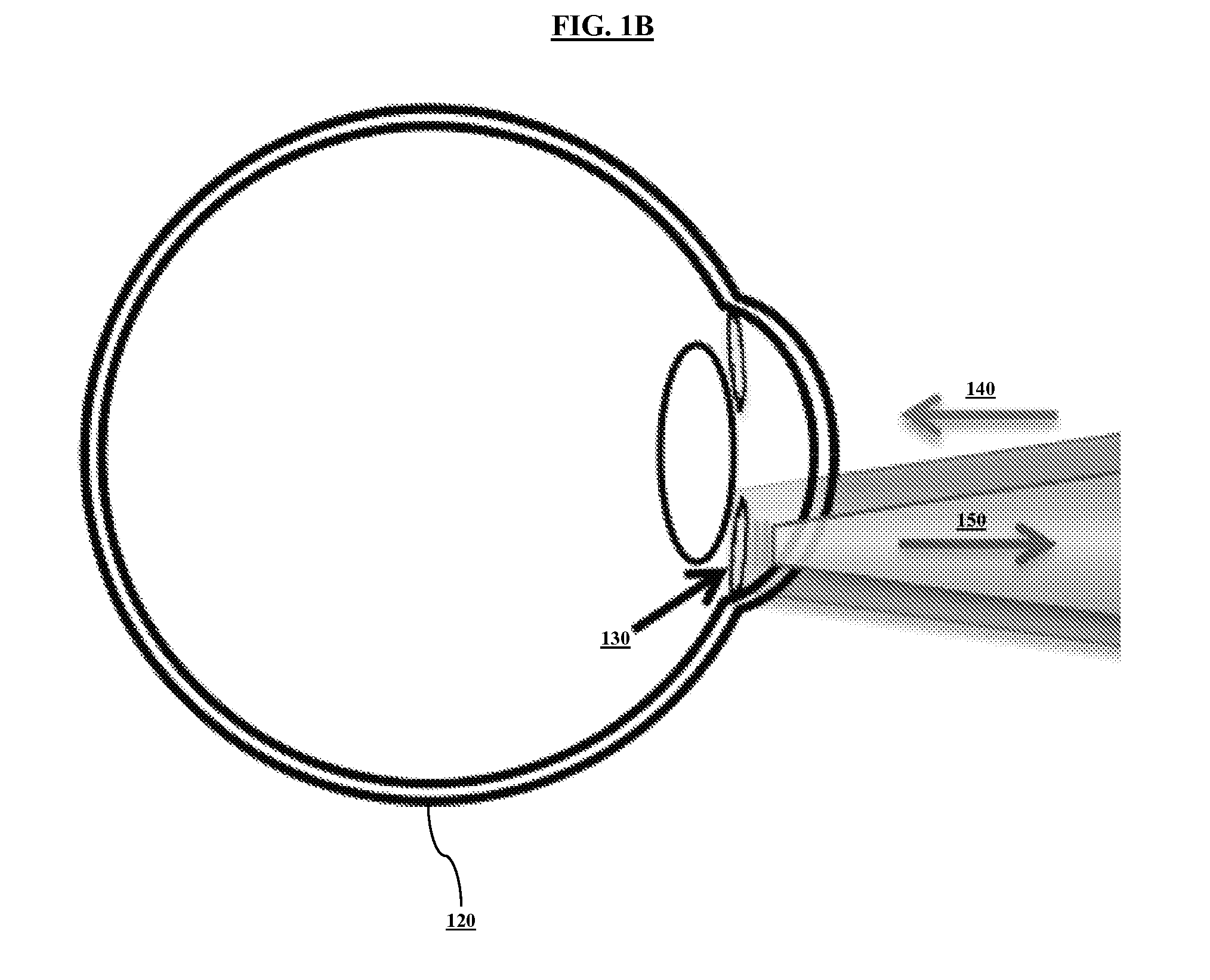 System and method for sensing intraocular pressure