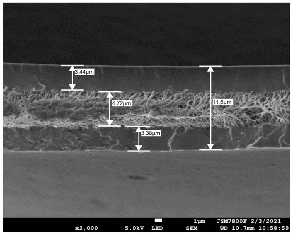 Phosphorylated polyvinyl alcohol/perfluorosulfonic acid resin compound and ion exchange membrane