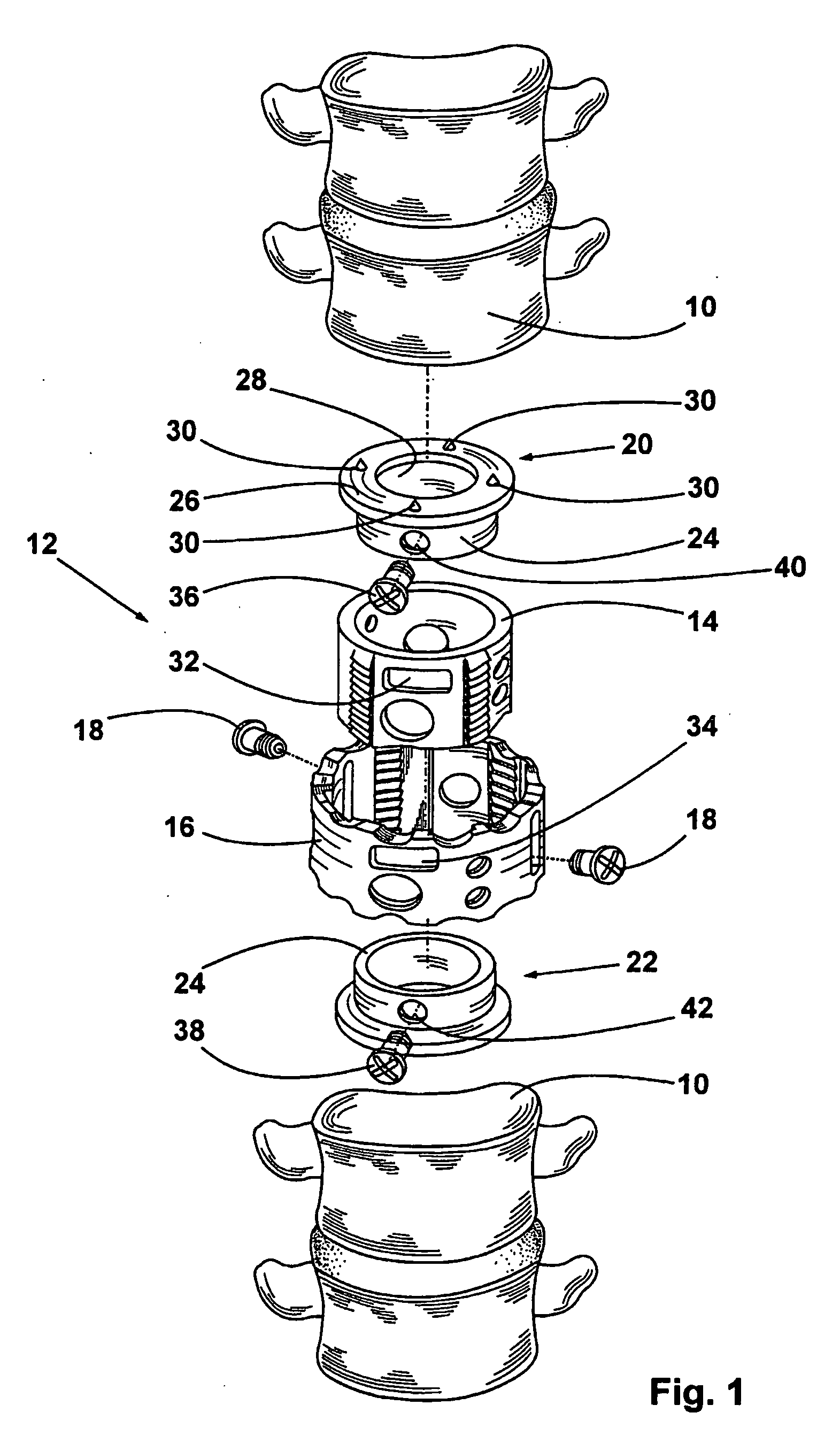 Vertrebal body placeholder