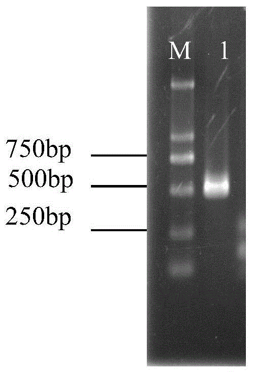 A kind of carboxylesterase gene dsrna and its application in the prevention and treatment of the wheat aphid