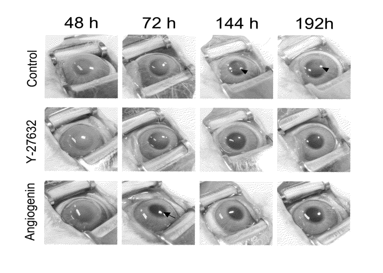 Pharmaceutical composition for treatment of corneal endothelial wounds containing angiogenin