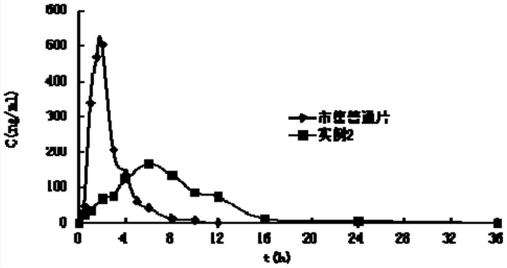 A kind of ivabradine hydrochloride osmotic pump controlled-release tablet and preparation method thereof