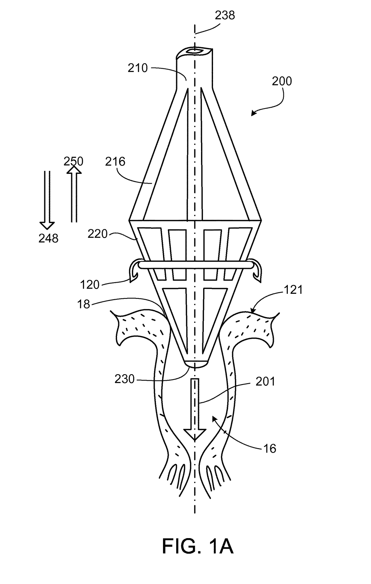 Reconfiguring tissue features of a heart annulus