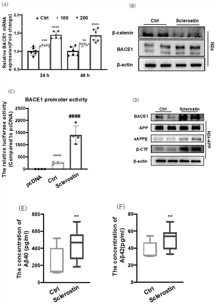 Sclerostin and application thereof in preparation of related products for treating or preventing Alzheimer's disease