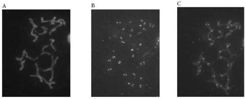 Brachypodium distachybes functional centromere antigen polypeptide and its application