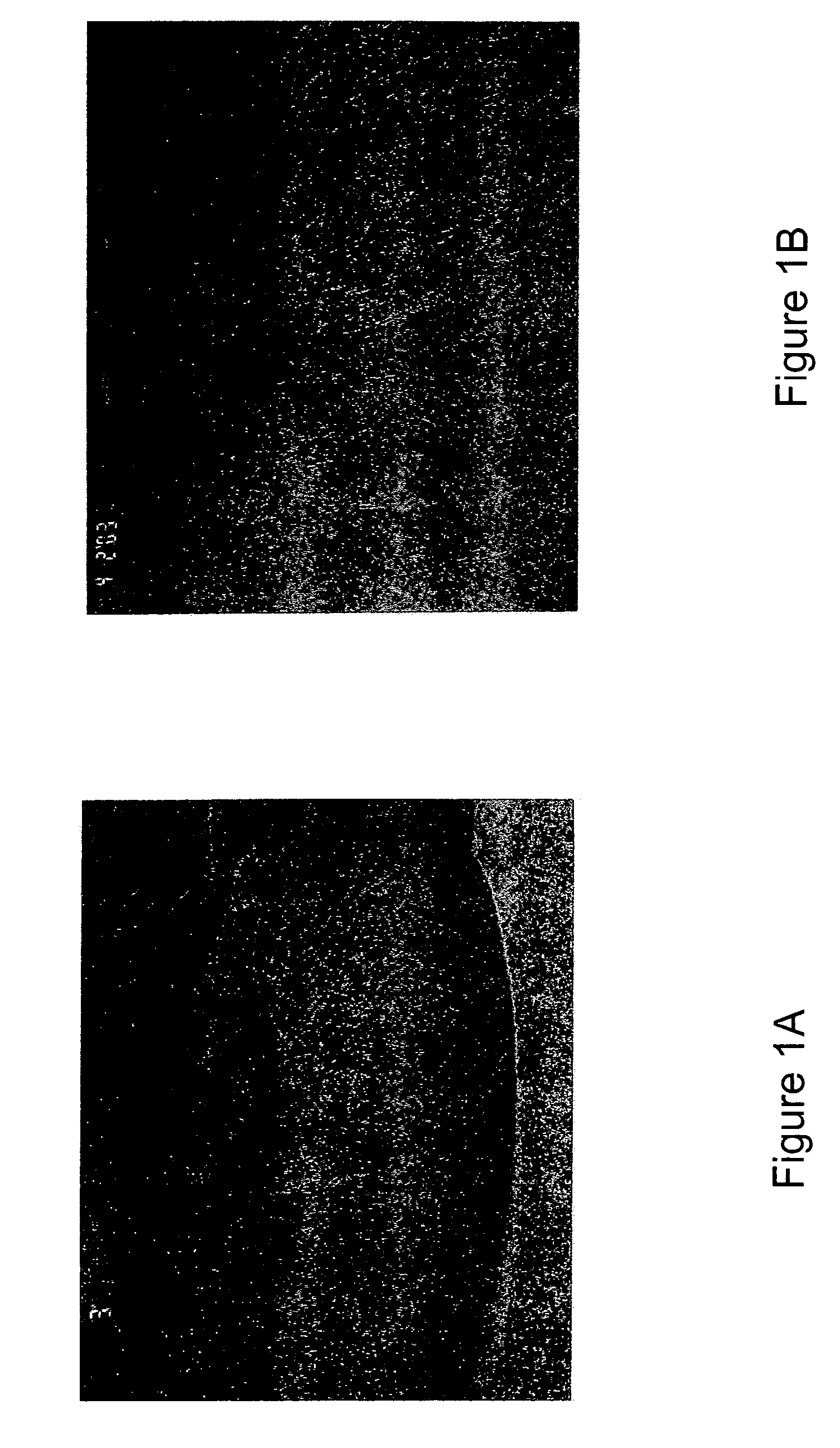 Method of treating granuloma annulare or sarcoid