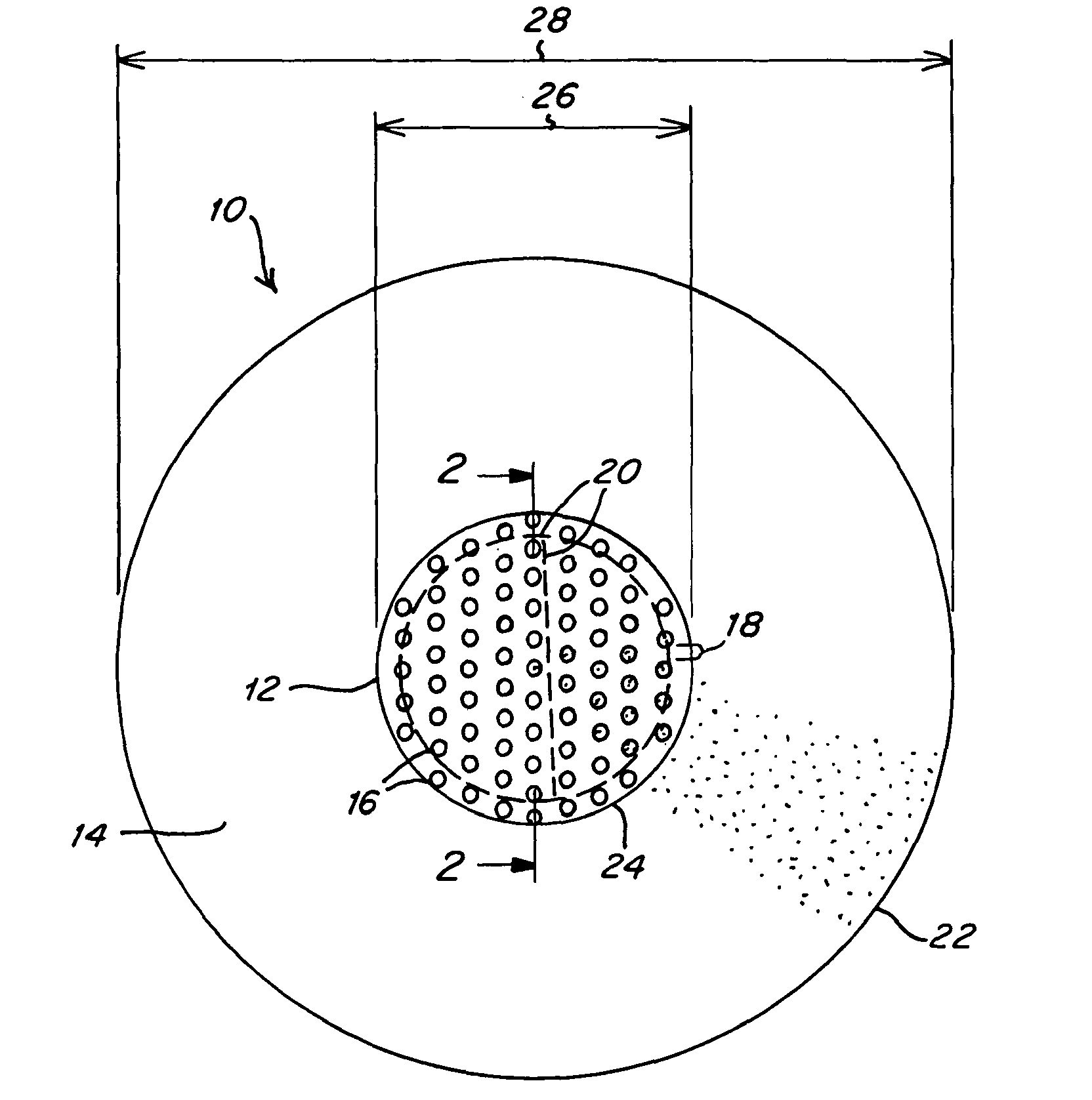 Implantable prosthesis