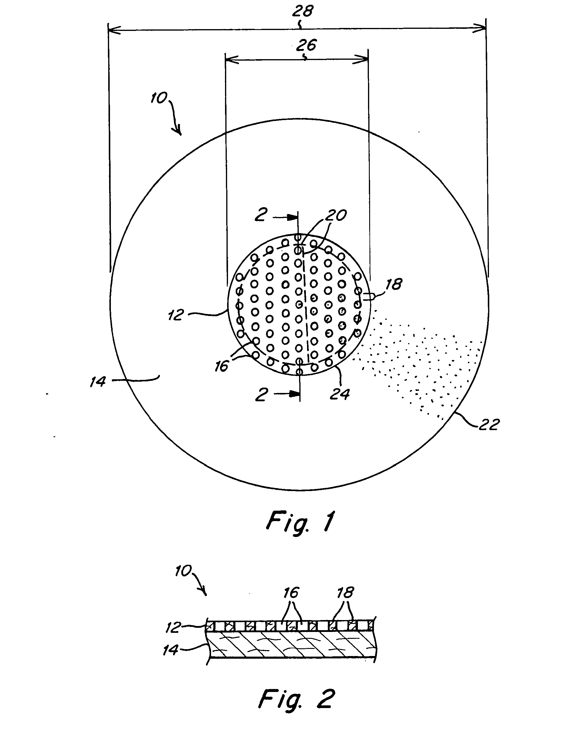 Implantable prosthesis