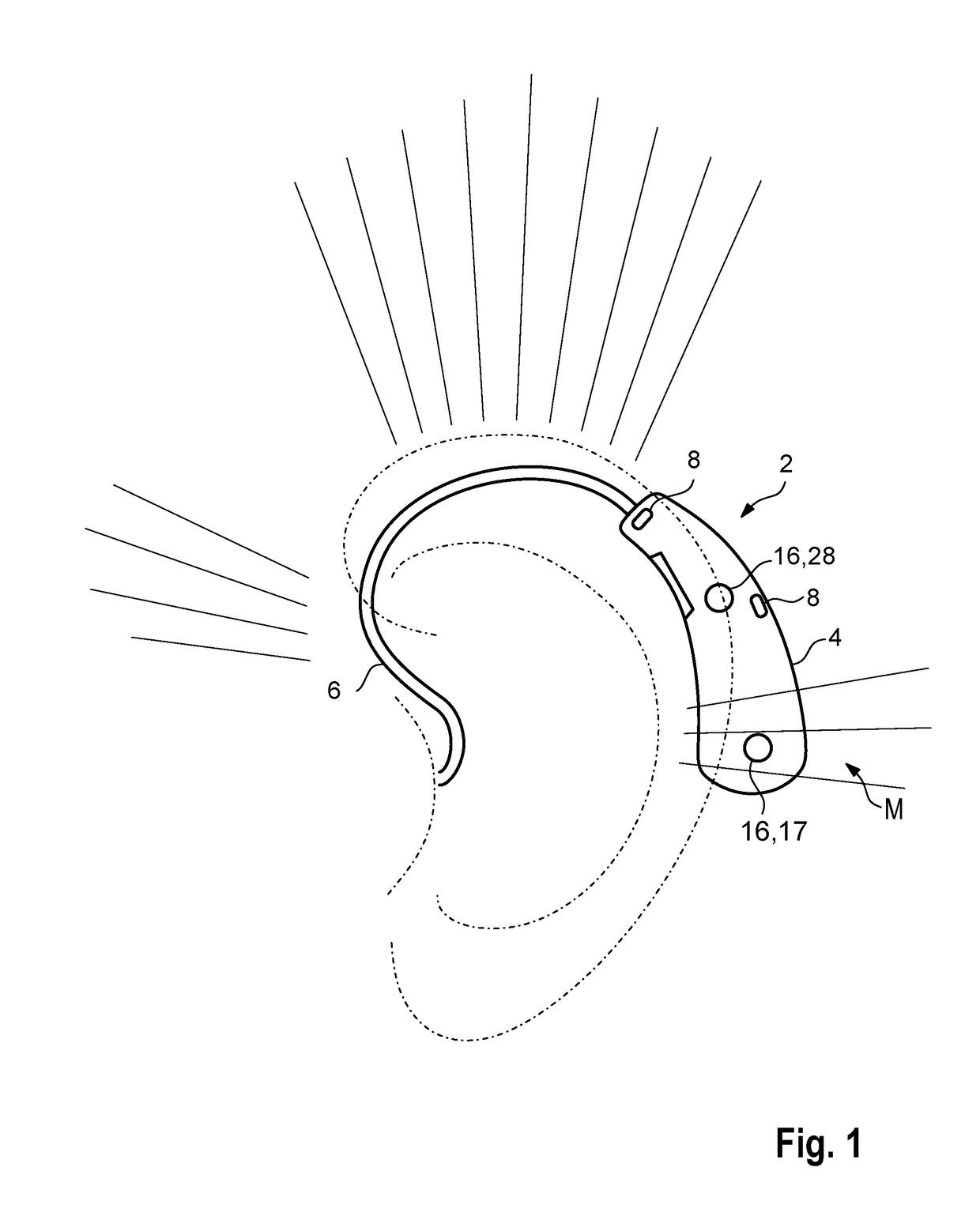 Method for operating a hearing device and hearing device