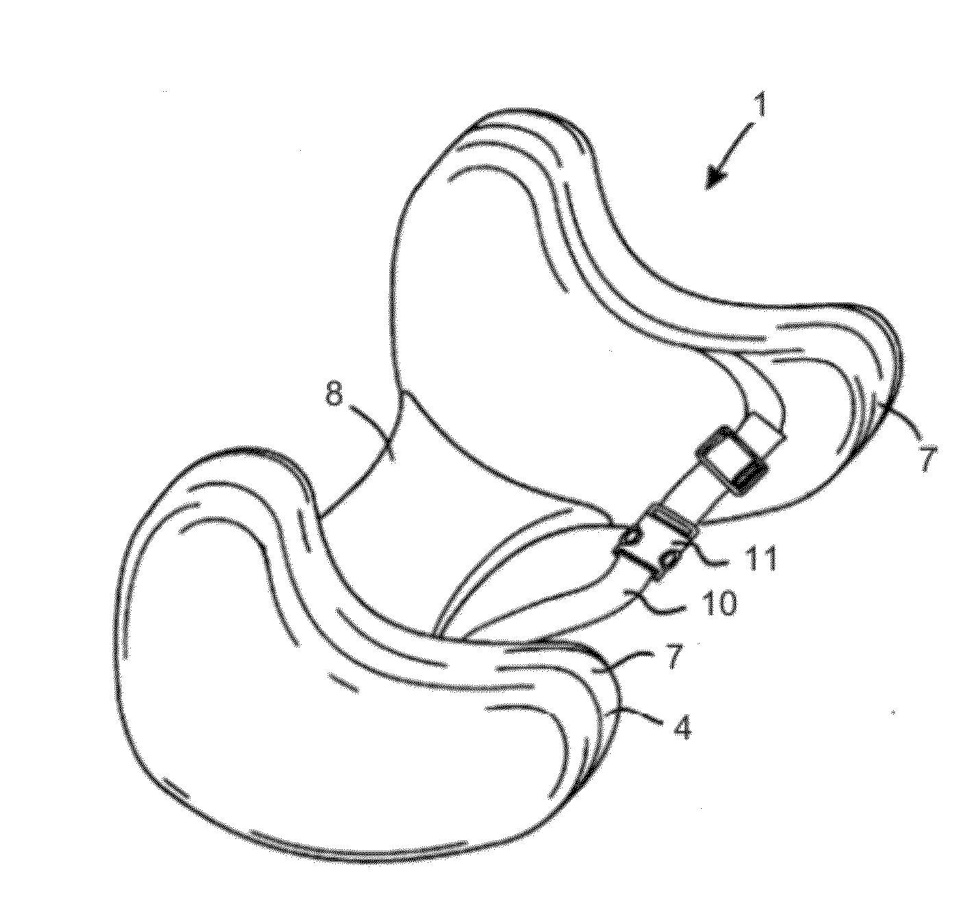 Apparatus for stimulating a reflexology point on a foot of a subject