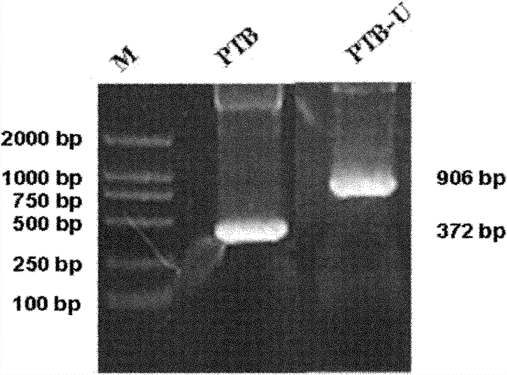 Recombinant ubiquitin ligase PTB-U-box fusion gene and expression vector and application thereof