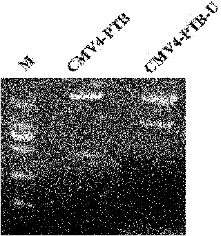 Recombinant ubiquitin ligase PTB-U-box fusion gene and expression vector and application thereof