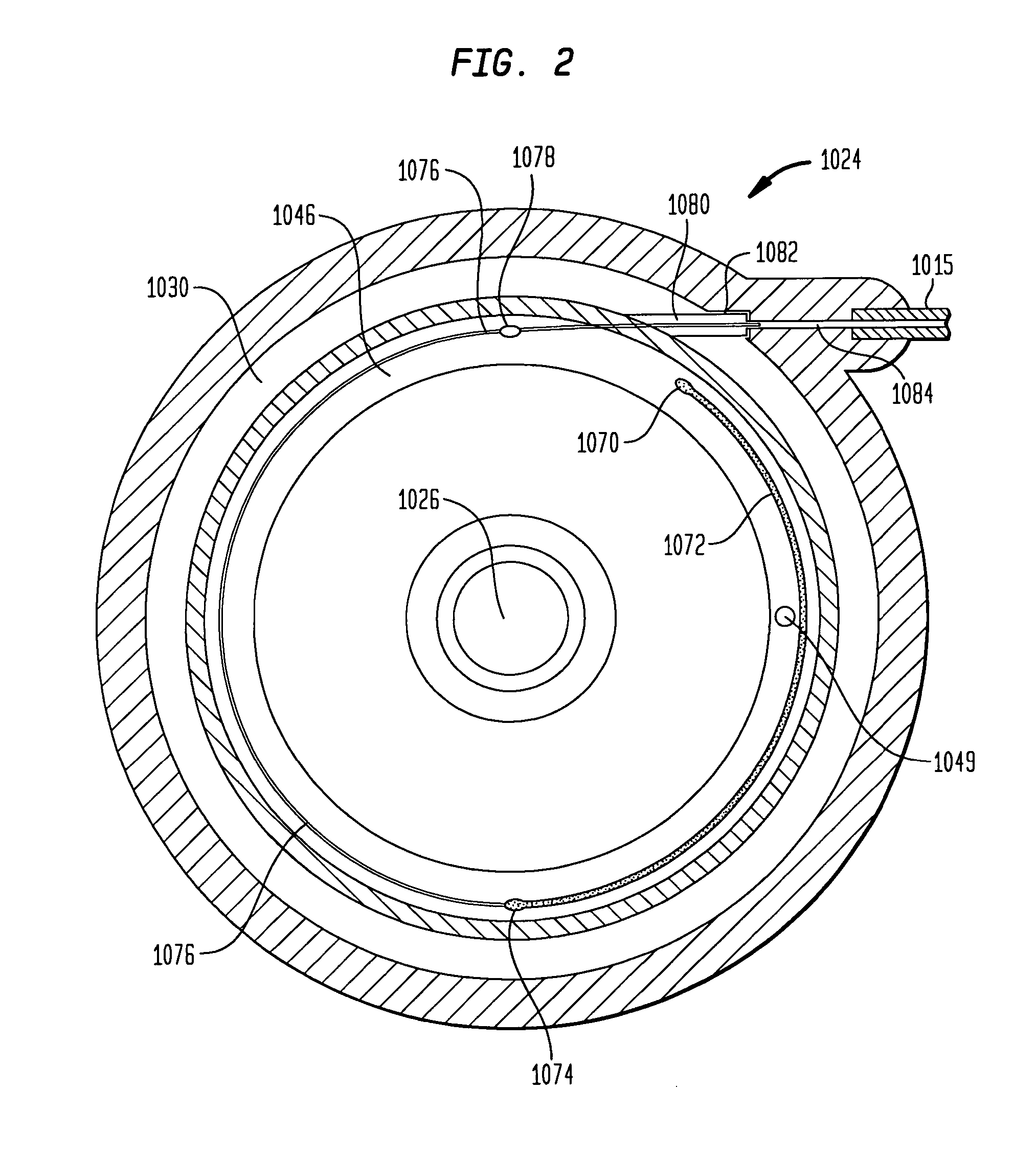 Implantable pump with infinitely variable resistor