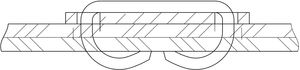 Suturing nail of circumcision instrument