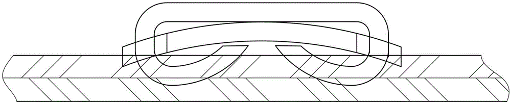 Suturing nail of circumcision instrument