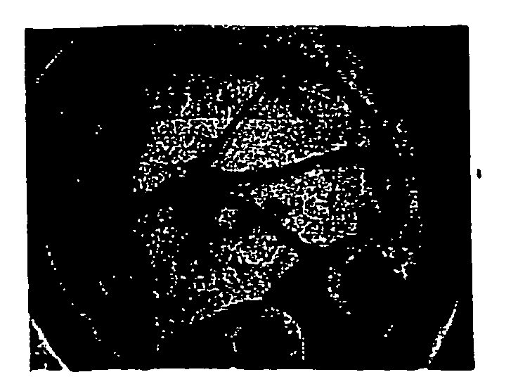 Methods for the treatment or prevention of obesity