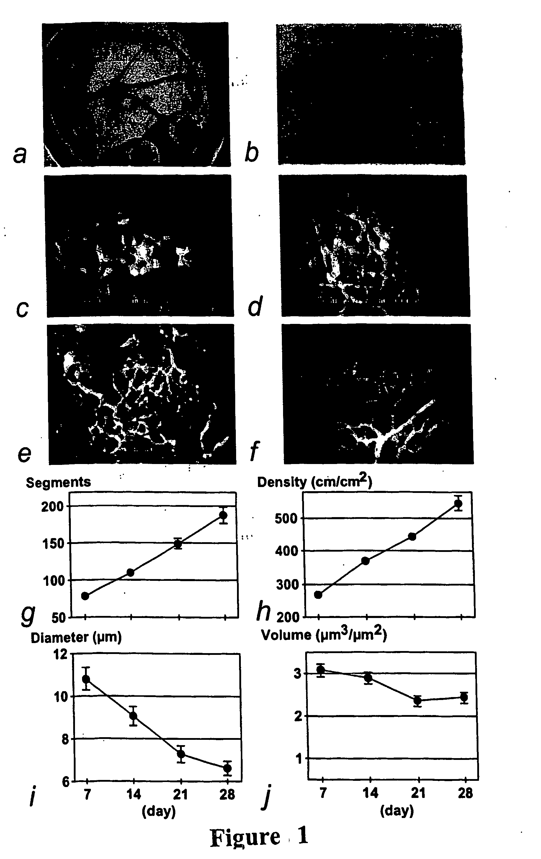 Methods for the treatment or prevention of obesity