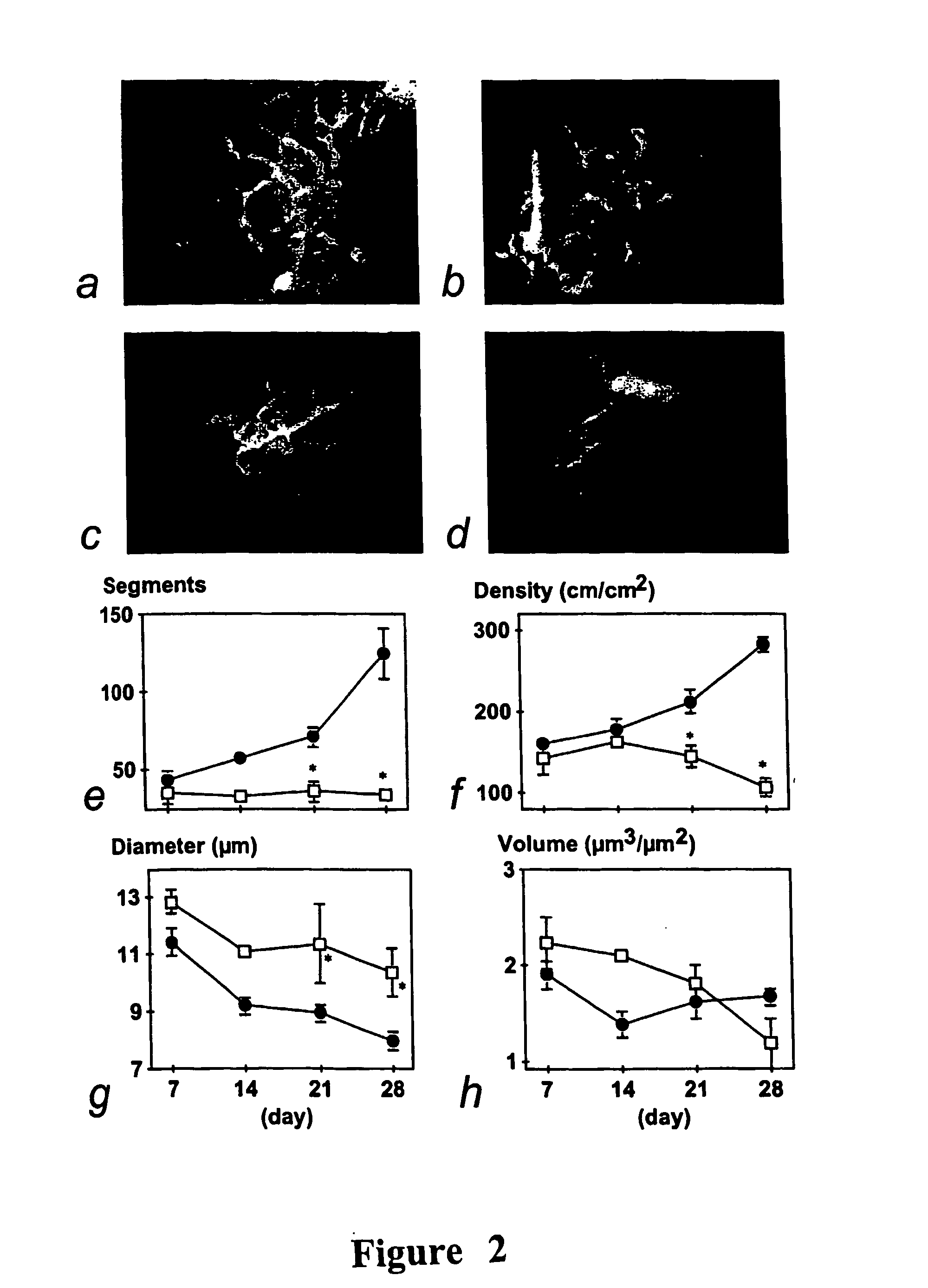 Methods for the treatment or prevention of obesity