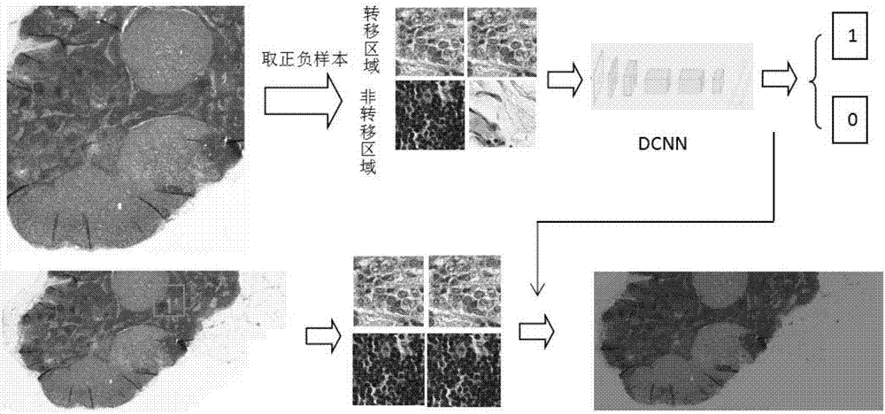 Method for automatically segmenting transfer region of a panoramic scanning pathology image