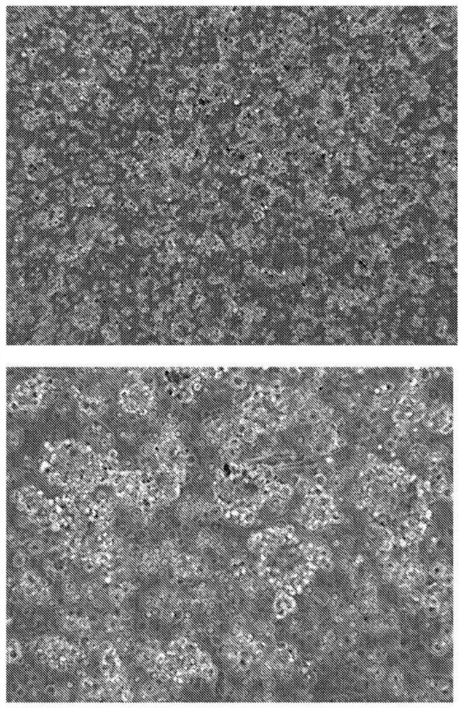 Expansion and differentiation of neuronal precursor cells