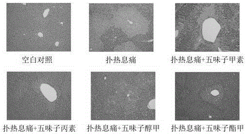 Application of schisandra monomer compound in the preparation of drugs for the prevention and treatment of hepatotoxicity caused by paracetamol