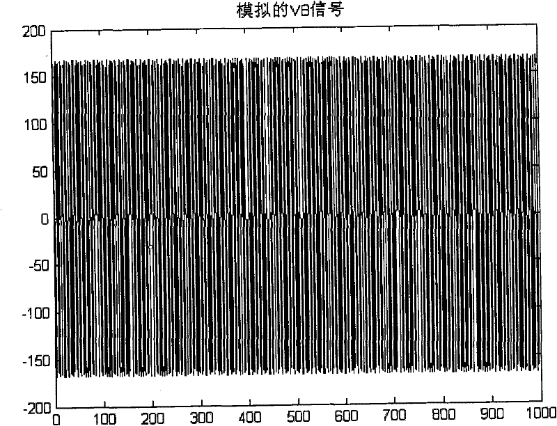 Method for removing magnetic resonance gradient noise in electroencephalograph signal