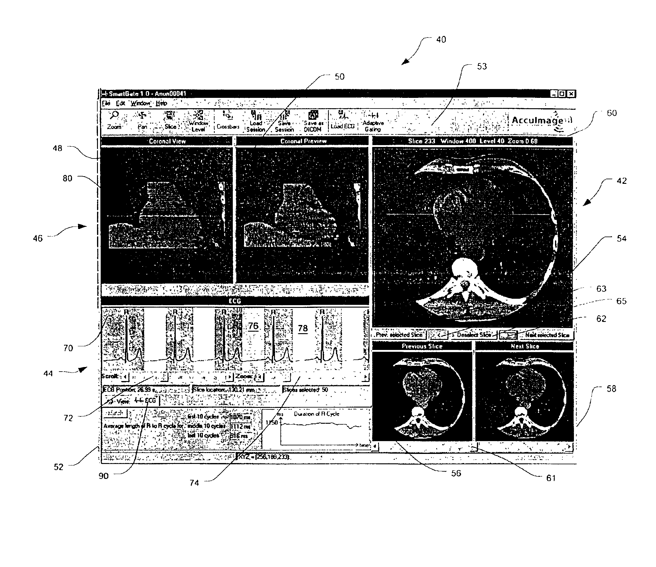 Graphical user interfaces and methods for retrospectively gating a set of images