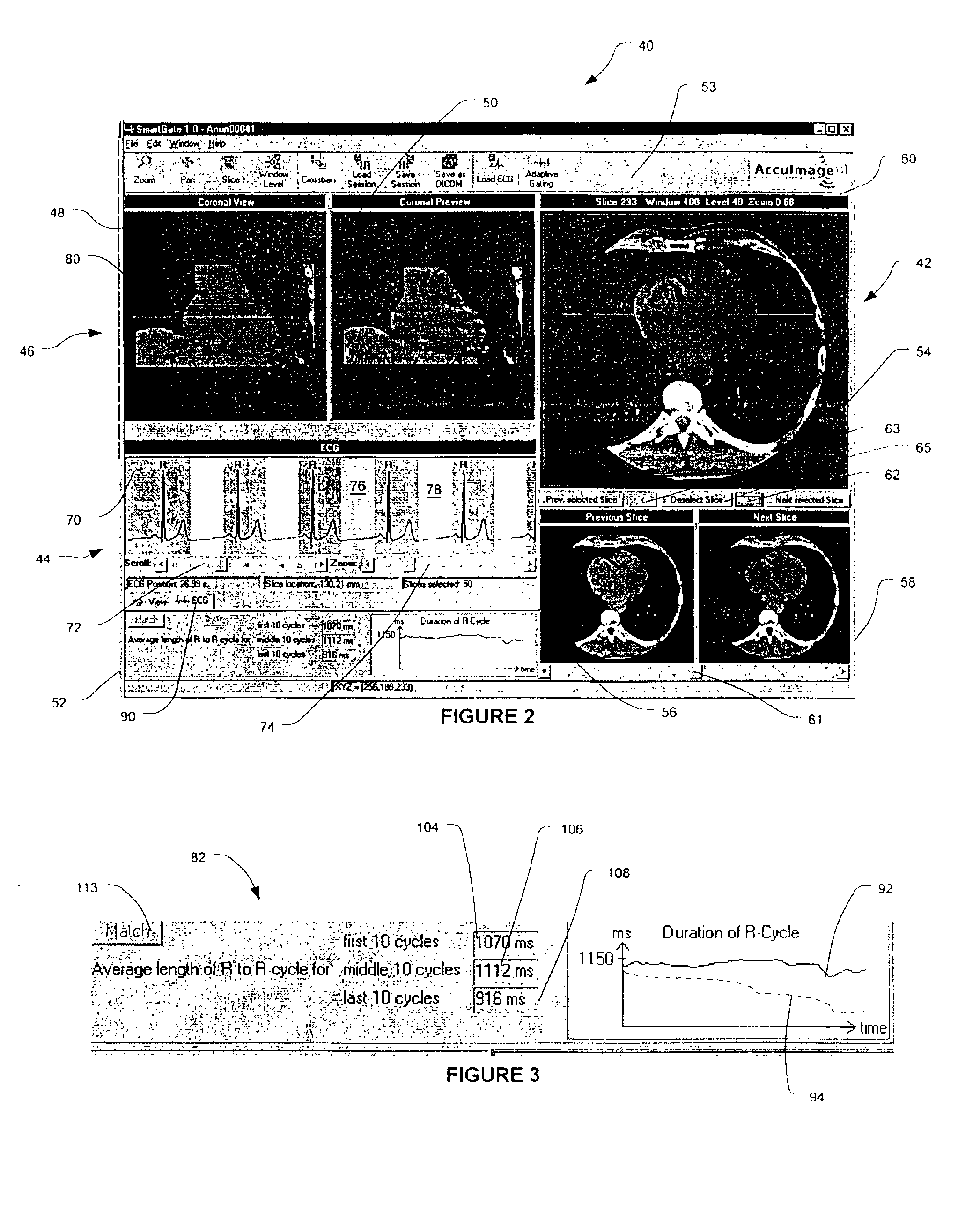 Graphical user interfaces and methods for retrospectively gating a set of images