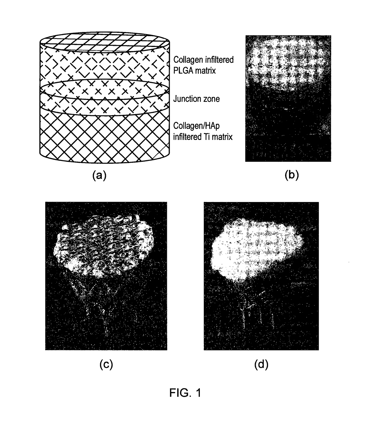 Osteochondral scaffold