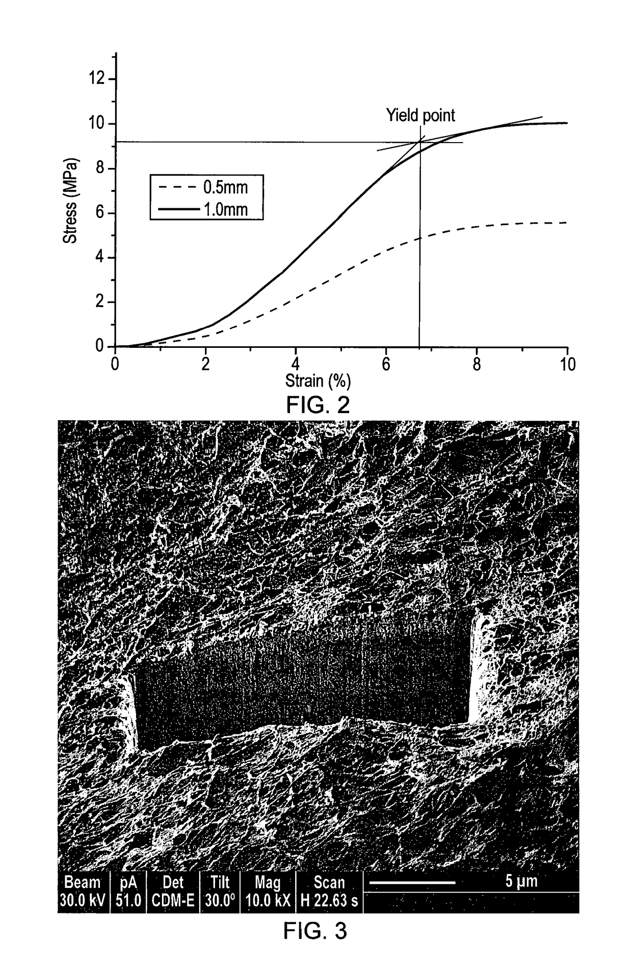 Osteochondral scaffold