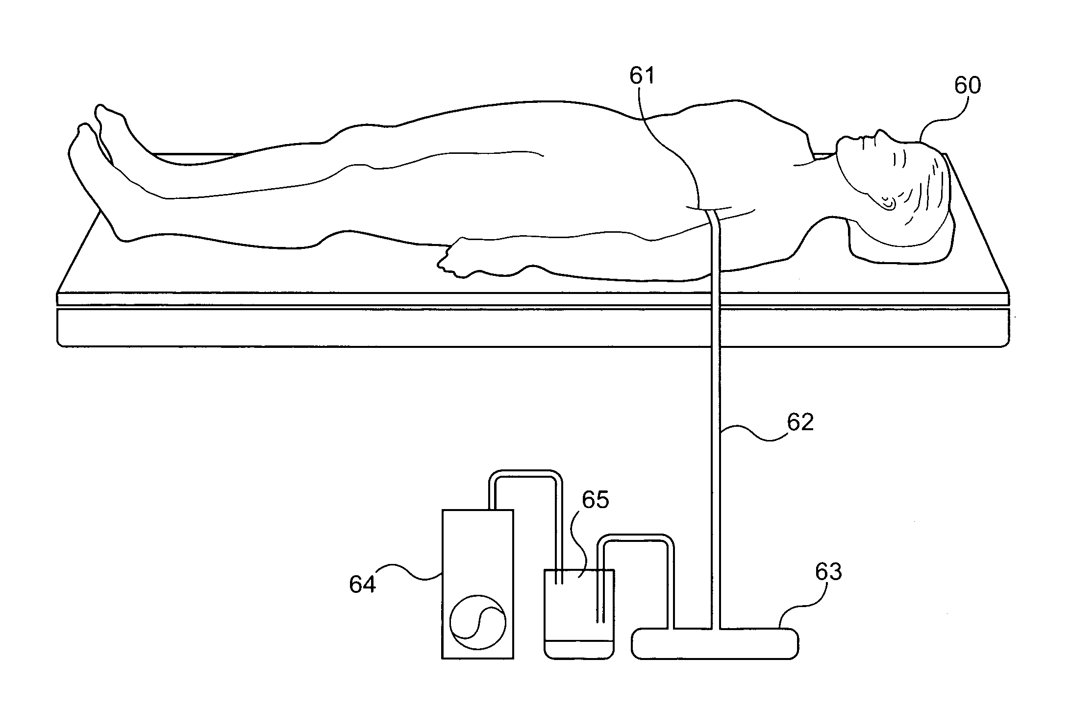 Catheter drainage system