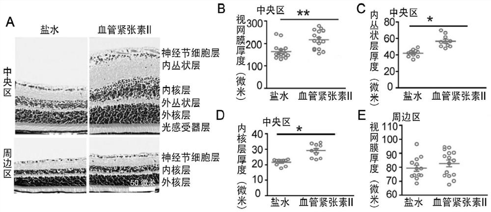 Preparation method and application of mouse hypertension fundus lesion model caused by continuous angiotensin II perfusion