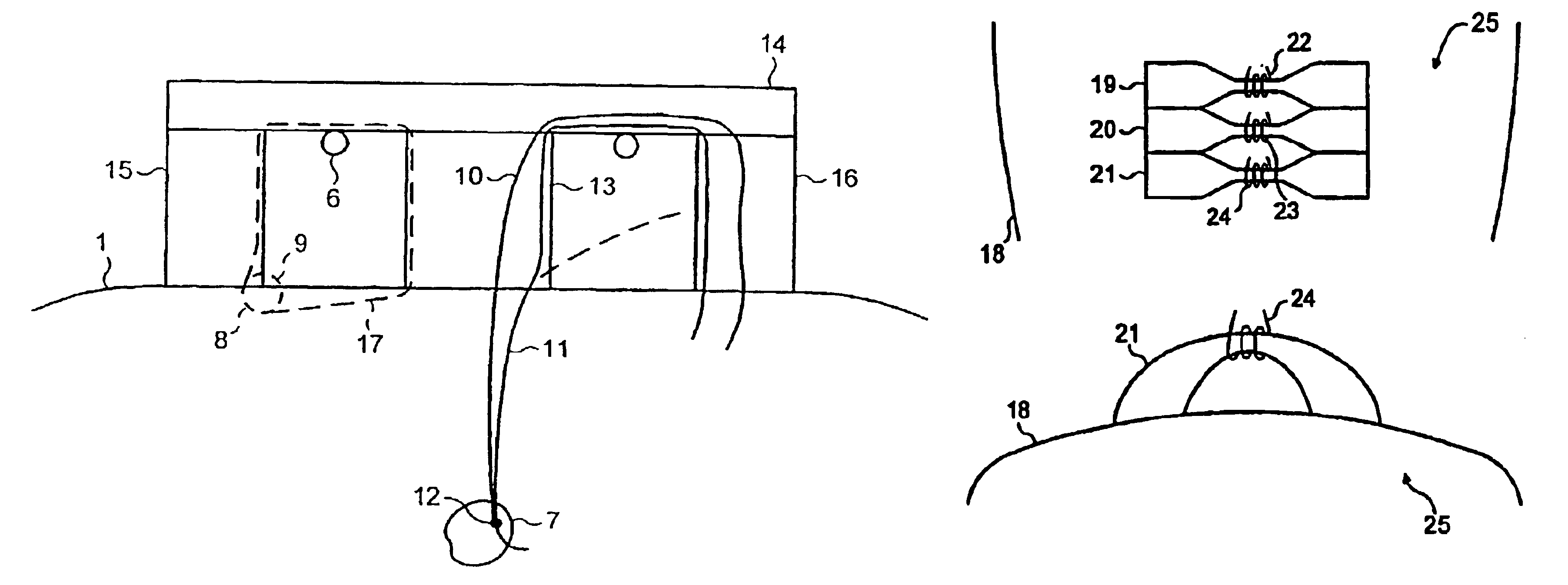 Magnetic resonance apparatus including an rf magnetic flux guiding structure for improving the signal-to-noise ratio